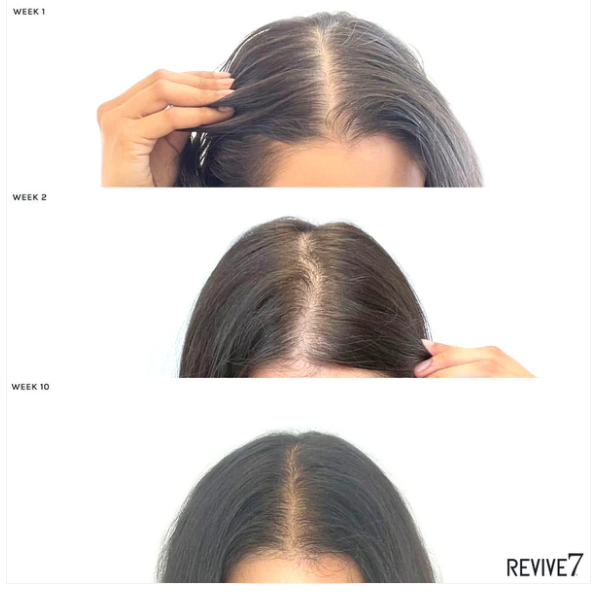 Revive7 Revitalizing Hair Treatment